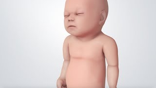 Infant Distress Warning Signs Grunting Baby Sound [upl. by Ettezus]