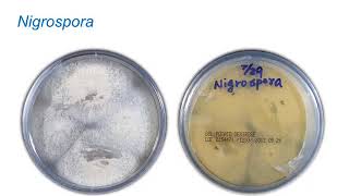 Identification of Melanized Dermatitiaceous Fungi Part 1 Hot Topic [upl. by Iffar]