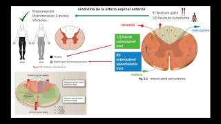 Lesiones de la Medula Espinal [upl. by Centonze]