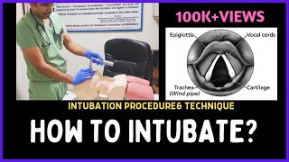 HOW TO INTUBATE INTUBATION PROCEDURE amp TECHNIQUE [upl. by Ayak]