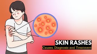 Skin Rash Causes Signs and Symptoms Diagnosis and Treatment [upl. by Ettelegna]