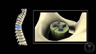 Neuroanatomy  The spinal cord [upl. by Anrak]