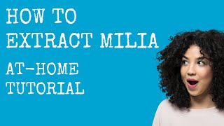 Shirley Says How To Extract Milia  AtHome Tutorial [upl. by Immak]