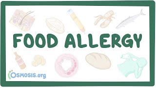 Managing Food Allergies in the School Setting [upl. by Quintina]