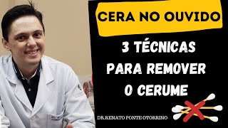 3 formas para remoção de cera no ouvido   DrRenato Ponte Otorrino [upl. by Goober]