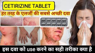 cetirizine hydrochloride tablets ip 10mg in hindi  Cetirizine tablets uses  Allergy Treatment [upl. by Darach]