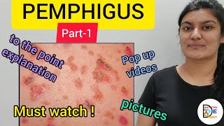 SKIN LESIONS PEMPHIGUS PART1 [upl. by Severen]