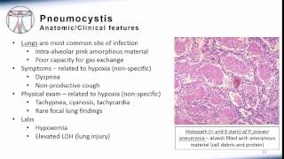 5 Pneumonia Pneumocystis [upl. by Adnahc]