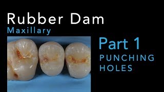 Rubber Dam Isolation Part 1 Punching Maxillary Holes [upl. by Adnahsor824]