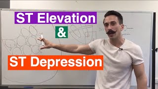 ST Elevation and ST Depression EXPLAINED [upl. by Notnelc]