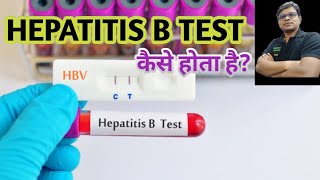 HBsAg test  Hepatitis B virus  Hepatitis B surface antigen test [upl. by Nede]