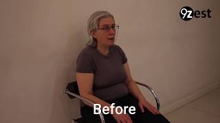 How Speech Therapy helps after Stroke [upl. by Byrne]