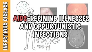 Opportunistic Infections and AIDSdefining illnesses  CD4 cell count malignancy treatment [upl. by Ytissahc]