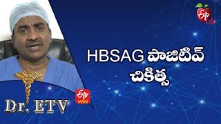 Hbsag Positive  Treatment  Hbsag పాజిటివ్ – చికిత్స  DrETV  2nd June 2022  ETV Life [upl. by Oflodur]