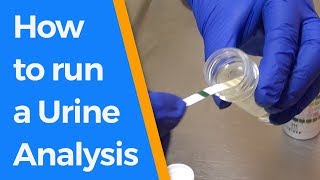 How to run a Urine Analysis [upl. by Anselm]