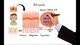 Pharmacology  ACNE TREATMENTS MADE EASY [upl. by Eiramlatsyrc87]